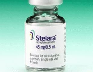 Stelar reviews for psoriasis